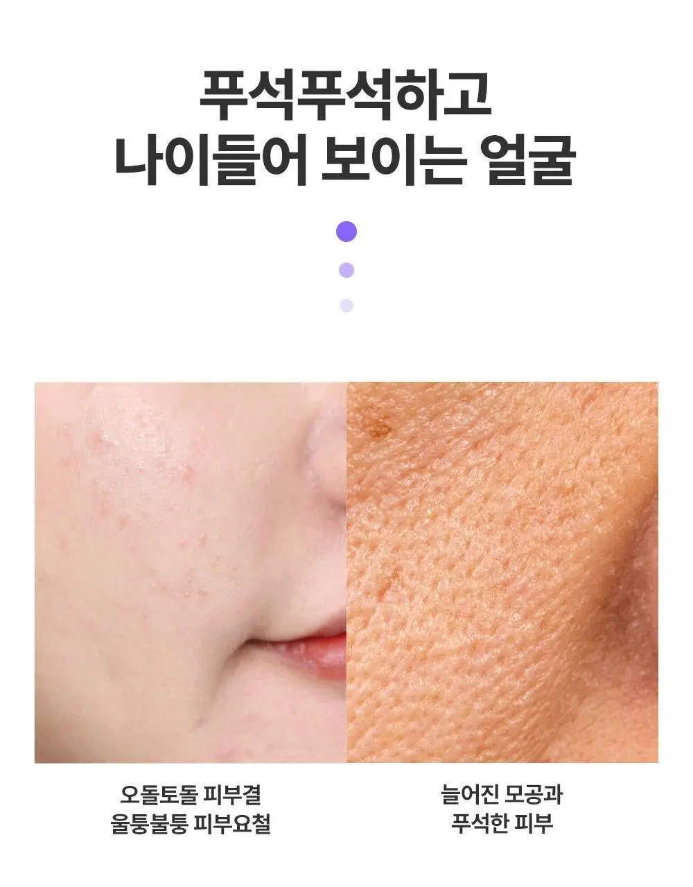 [올영단독/1+1+1] 프랭클리 모공축소 클로저 세럼 30ml 3입 기획 대용량앰플 상세페이지 12